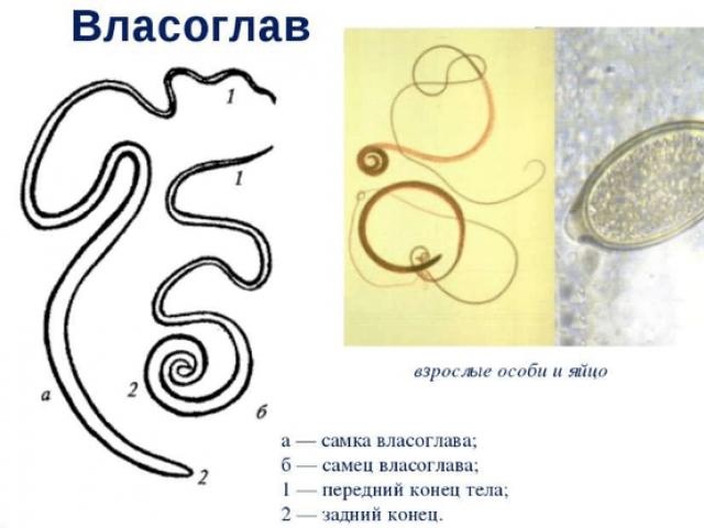 Паразиты в человеке и их признаки