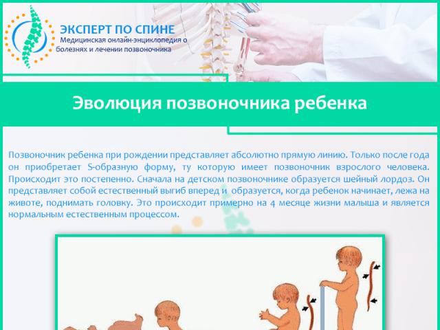 एक बच्चे में स्कोलियोसिस के उपचार के कारण और विशेषताएं